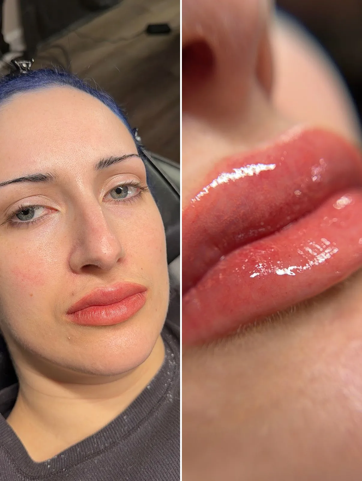 Lip Blush — before and after